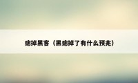 痣掉黑客(黑痣掉了有什么预兆)